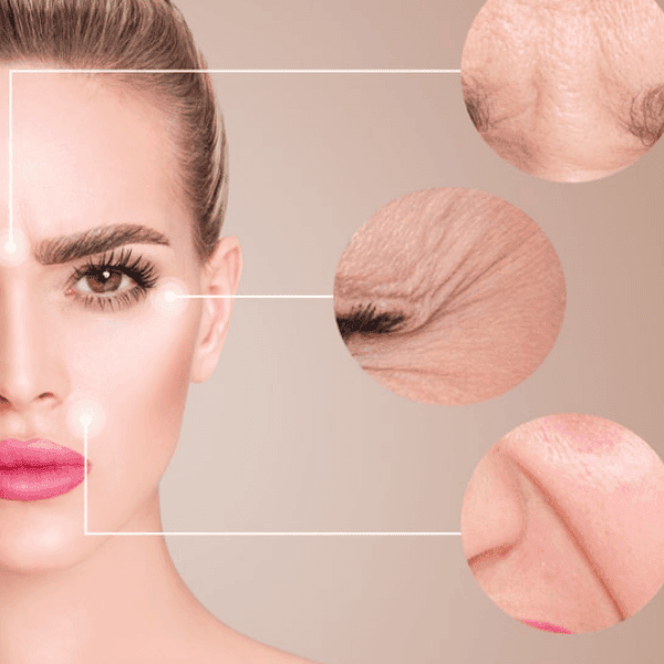 wrinkle treatment near mokena