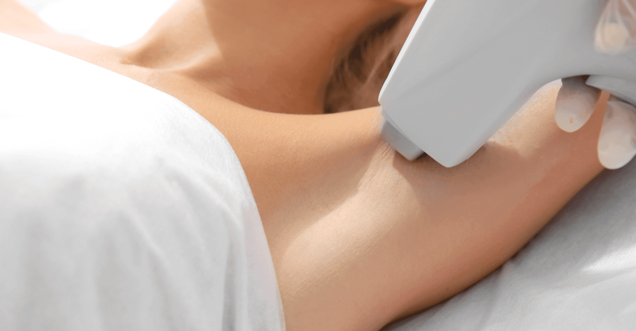 laser hair removal in mokena