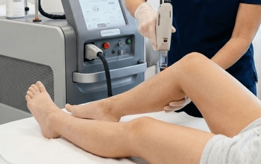 Laser Hair Removal Near New Lenox IL