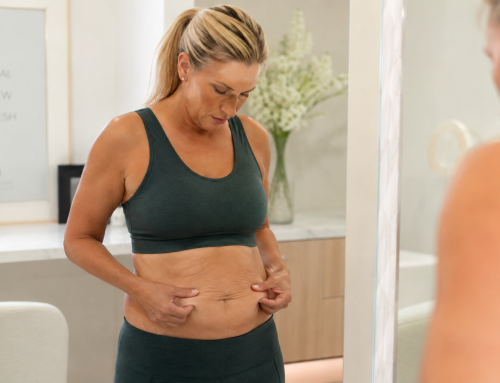 How to Tighten Loose Skin After Weight Loss Without Surgery: What Actually Works?
