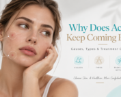 Woman examining recurring acne breakouts on her face while learning why acne keeps coming back and what may cause persistent breakouts